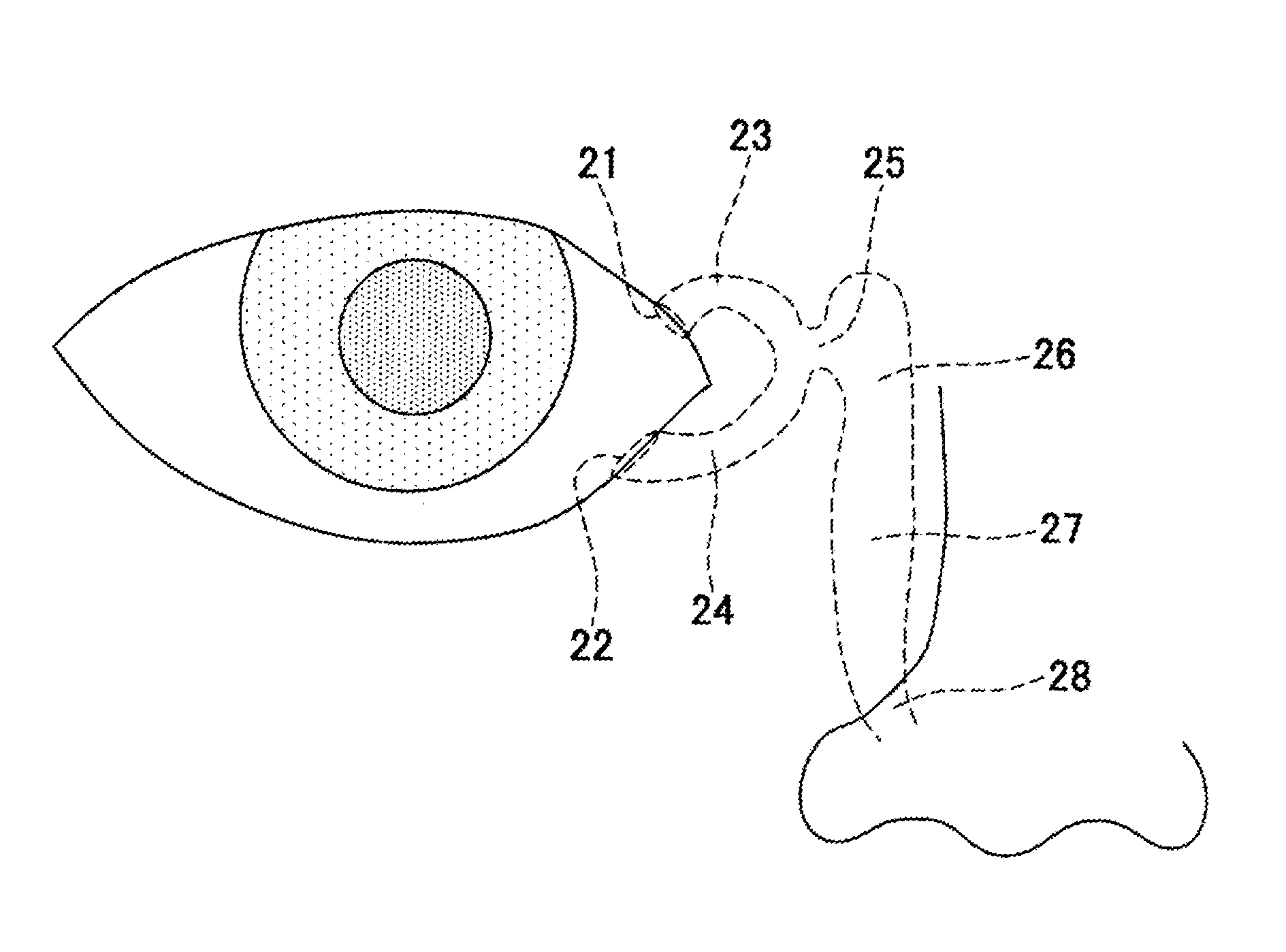 Lacrimal duct tube