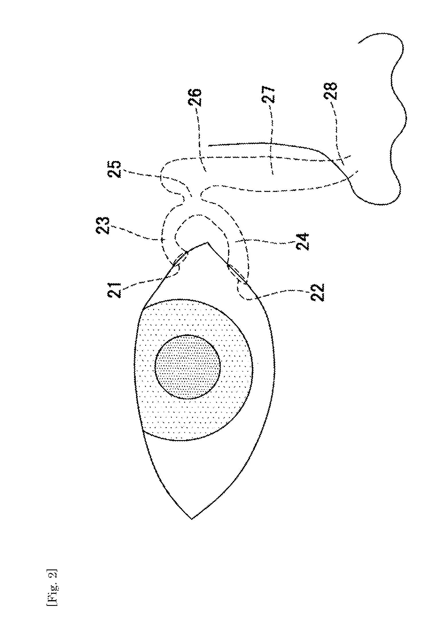 Lacrimal duct tube