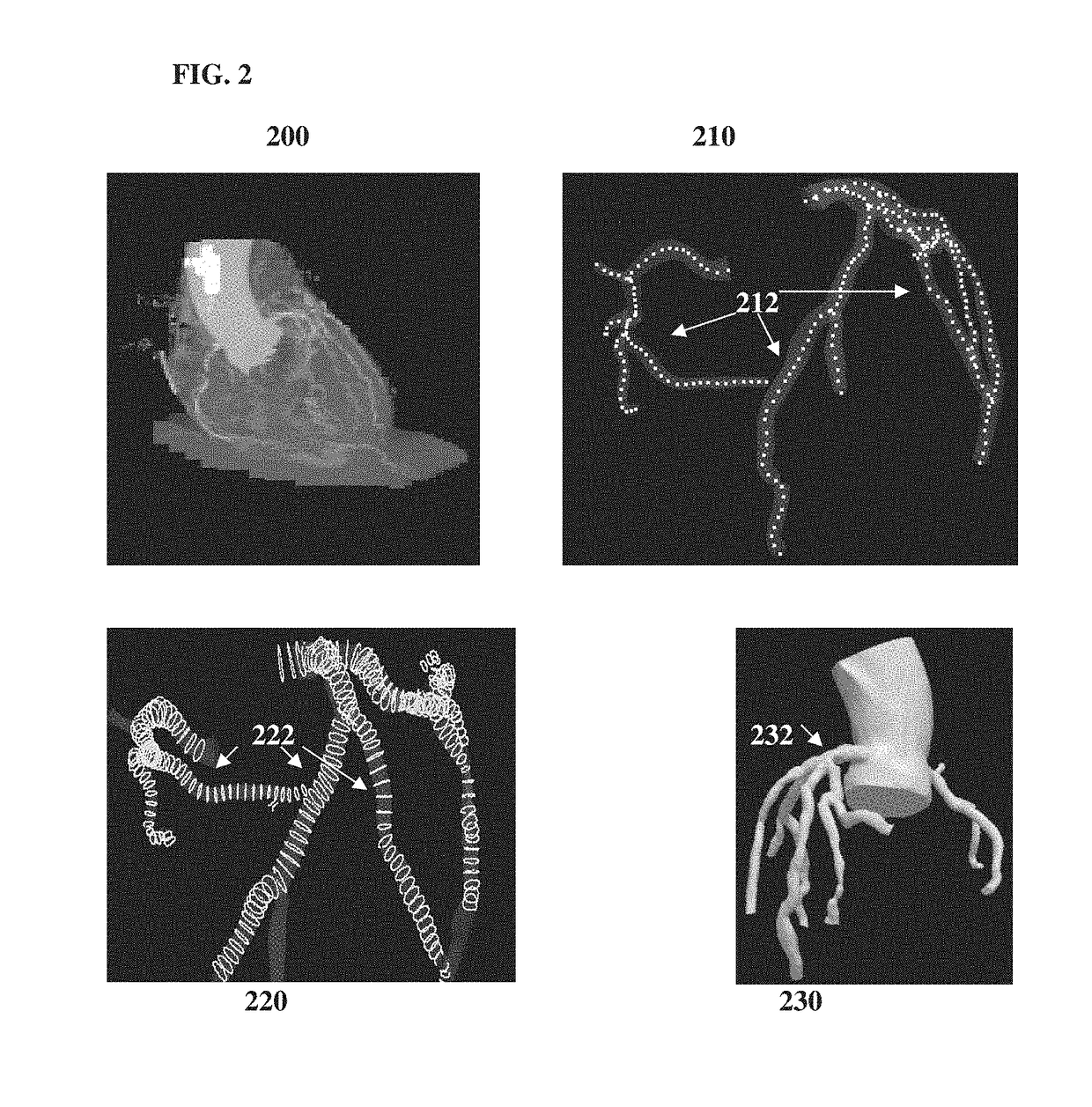 Method and system for prediction of post-stenting hemodynamic metrics for treatment planning of arterial stenosis