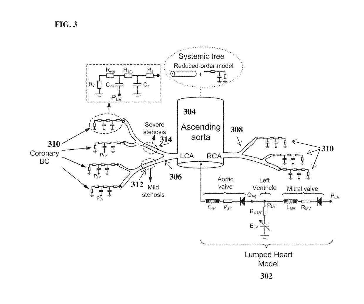 Method and system for prediction of post-stenting hemodynamic metrics for treatment planning of arterial stenosis