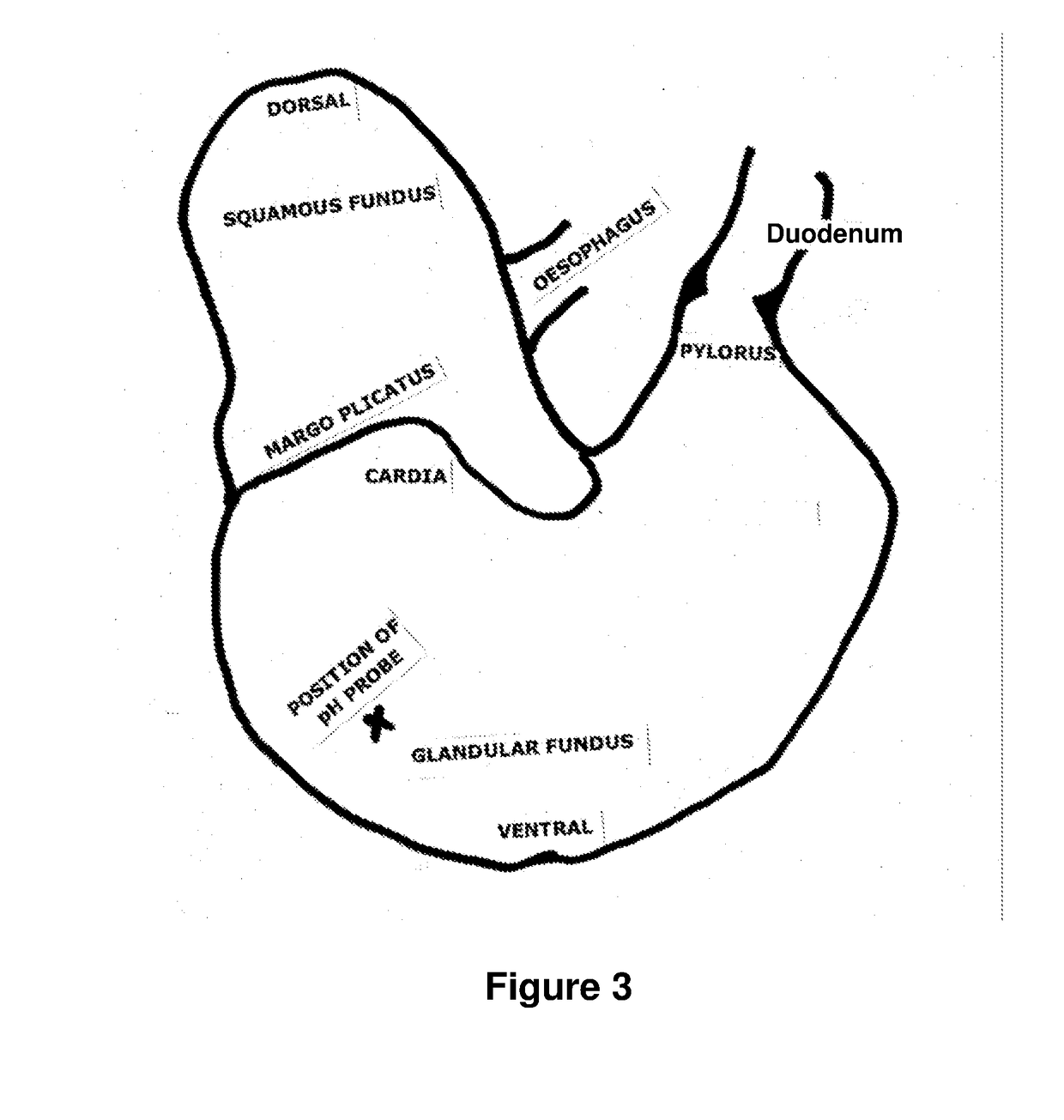 Methods and compositions for treating gastric ulcers