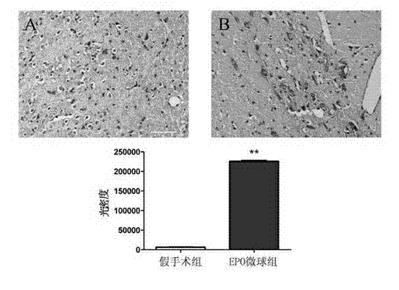 Application of erythropoietin microspheres to preparation of drugs for treating motor complications in Parkinson's disease