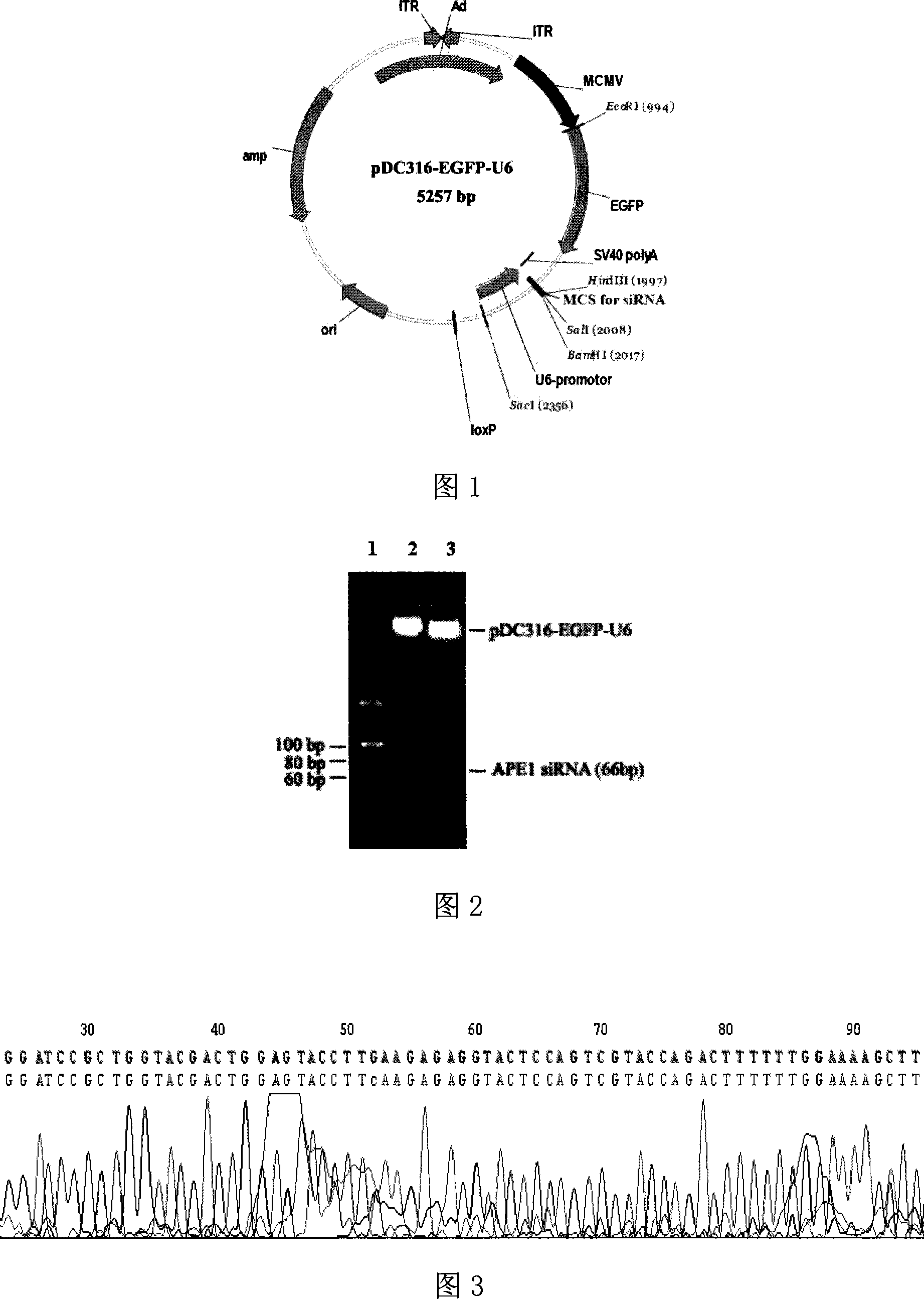 Method for constructing replication defect type recombination adenovirus