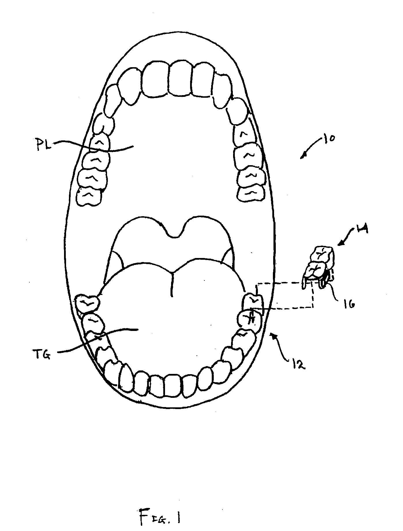 Methods and apparatus for processing audio signals