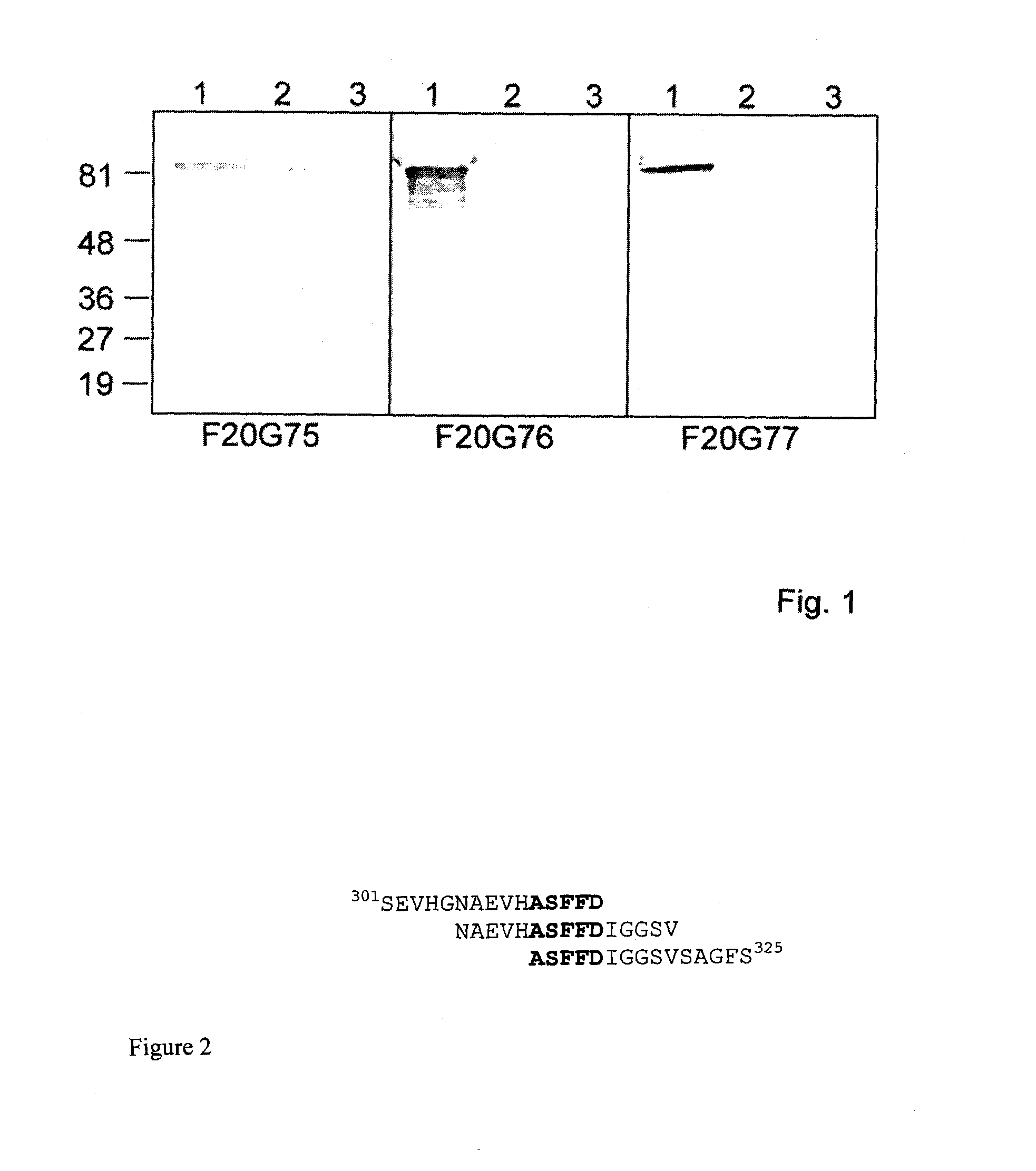 Monoclonal antibodies to anthrax protective antigen