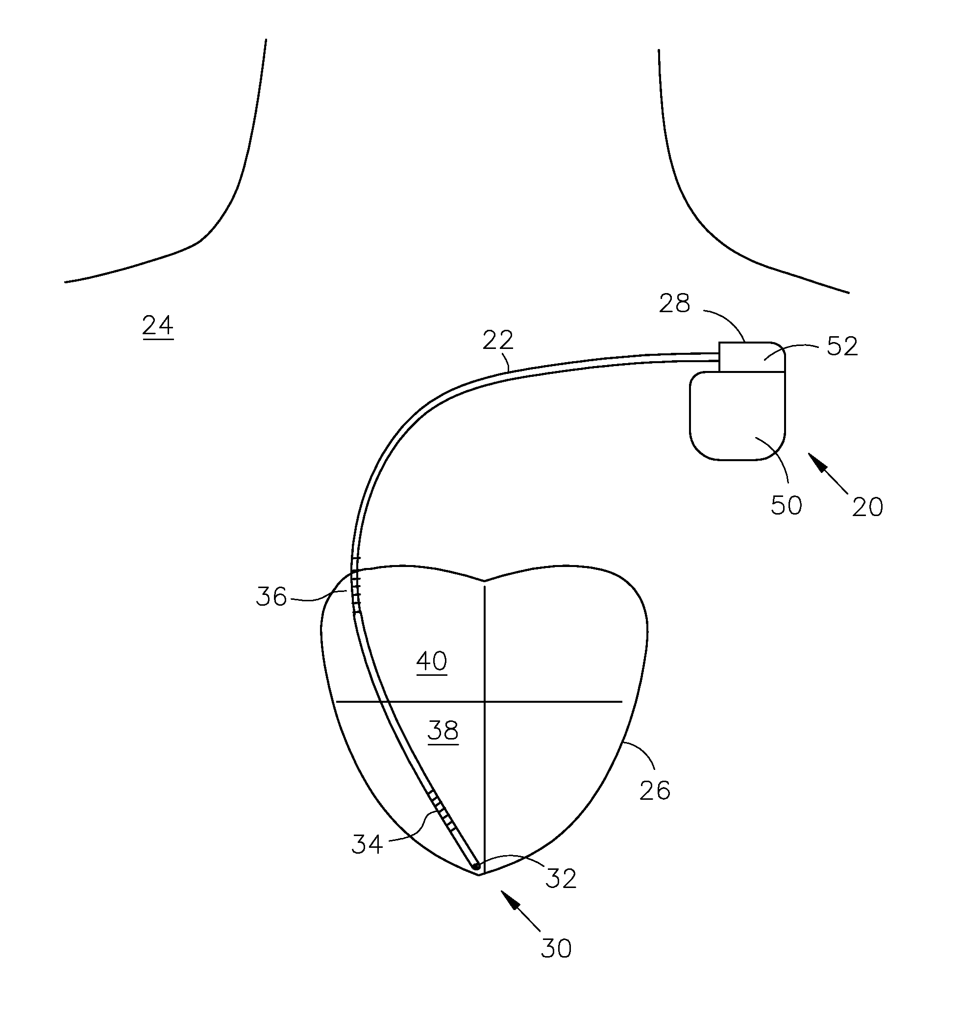 System and method for correlation of patient health information and implant device data