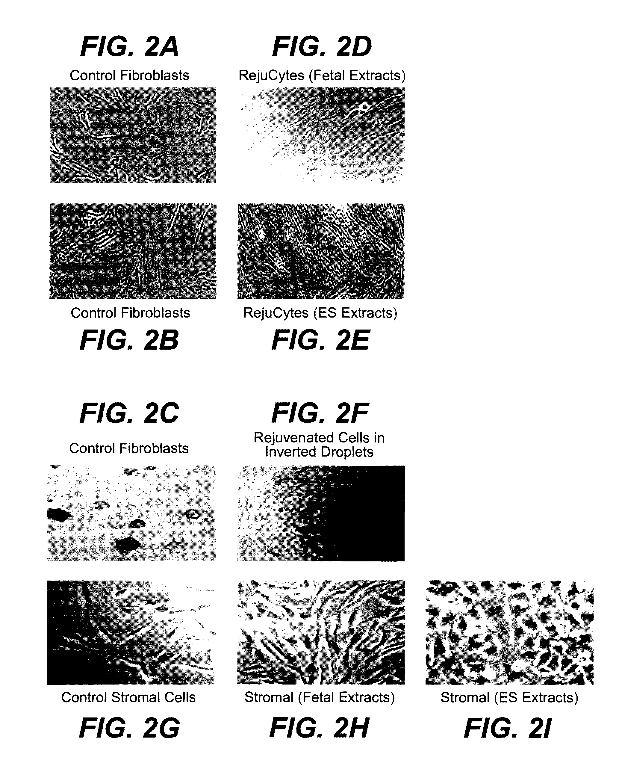 Methods of Rejuvenating Cells In Vitro and In Vivo