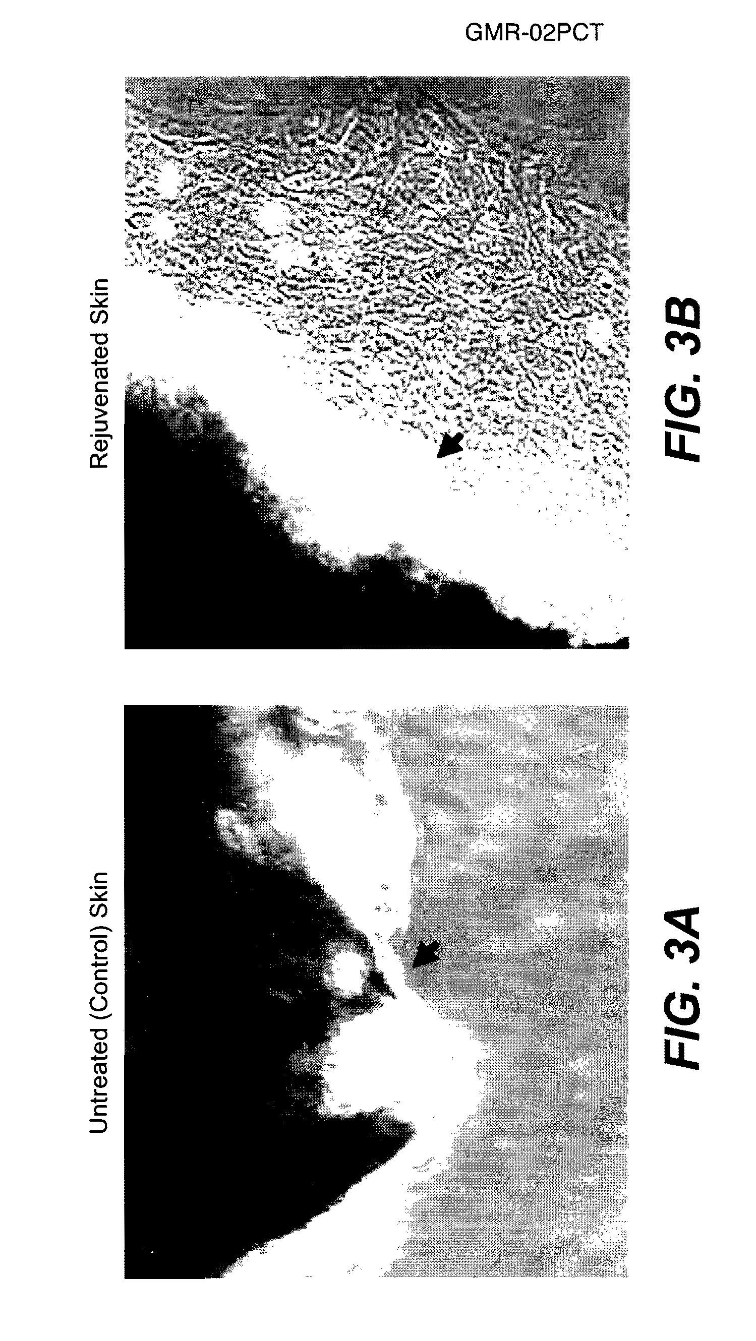 Methods of Rejuvenating Cells In Vitro and In Vivo