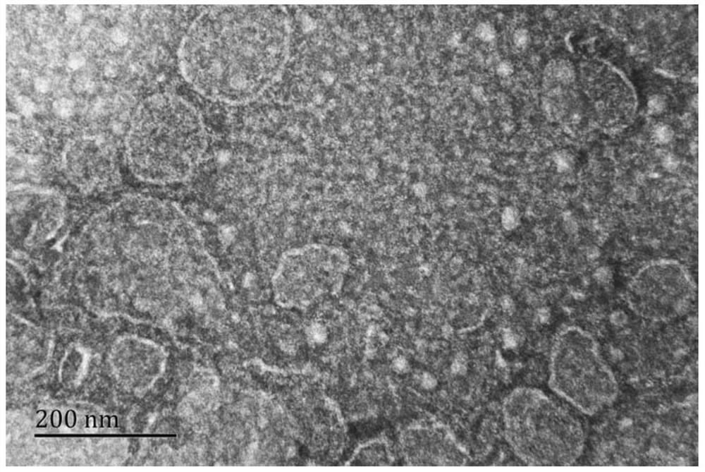 Method for preparing cell microvesicles based on shear stress stimulation