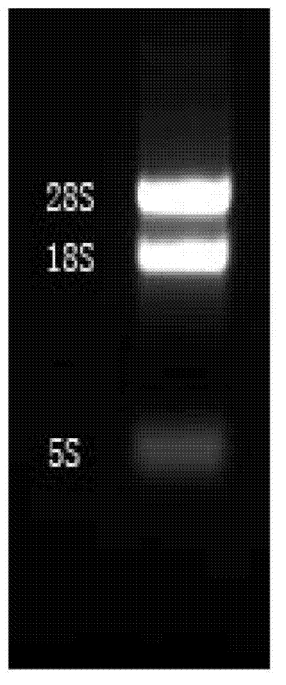 Chicken E.tenella MA2 gene, vector, recombinant strain, protein, and application thereof