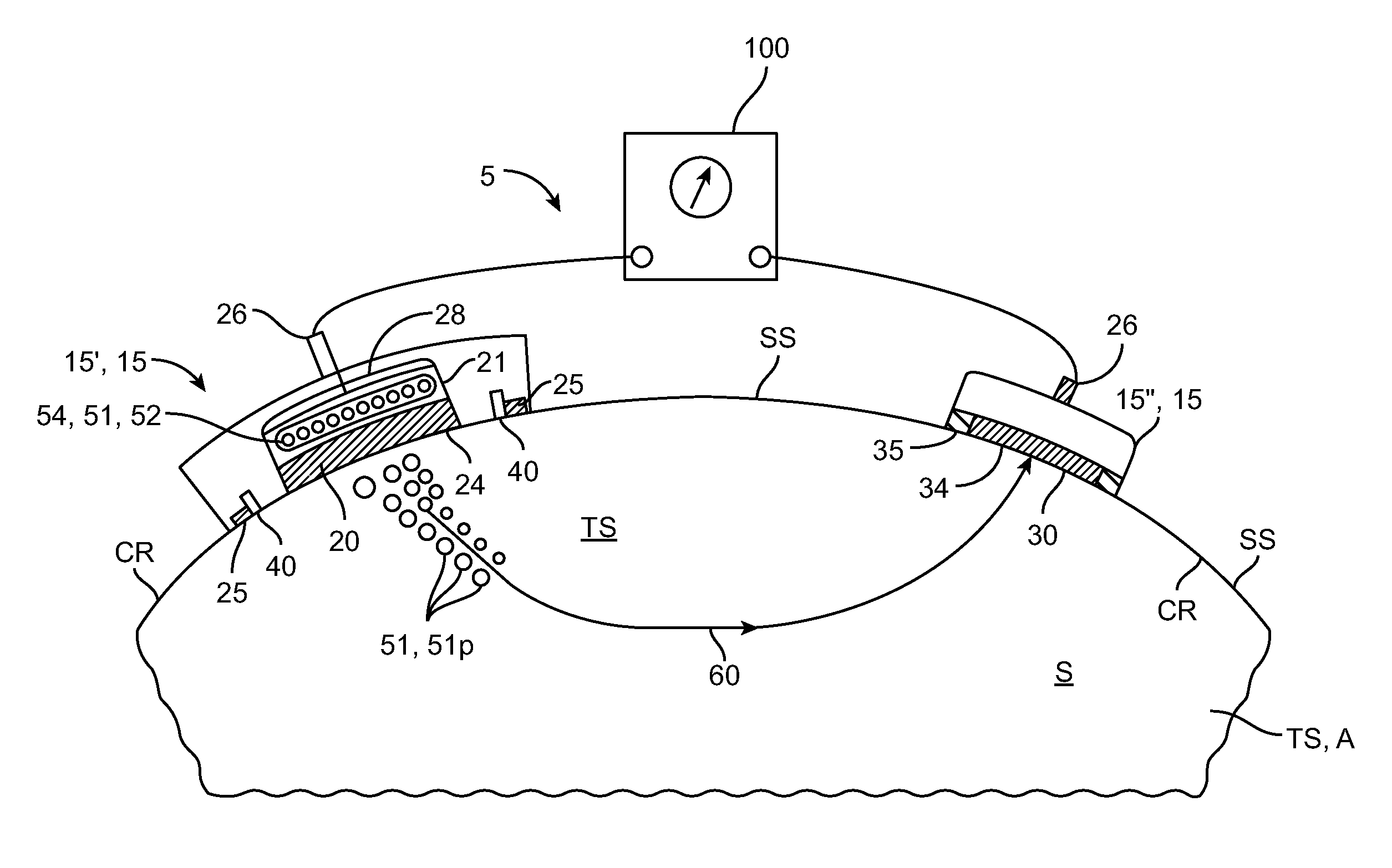 System and method for biphasic transdermal iontophoretic delivery of therapeutic agents for the control of addictive cravings