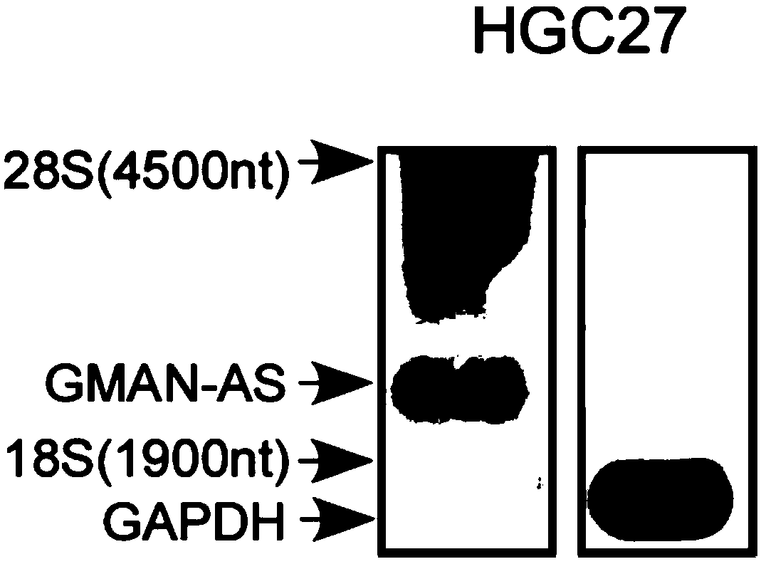 Polynucleotide for tumor treatment and application of polynucleotide