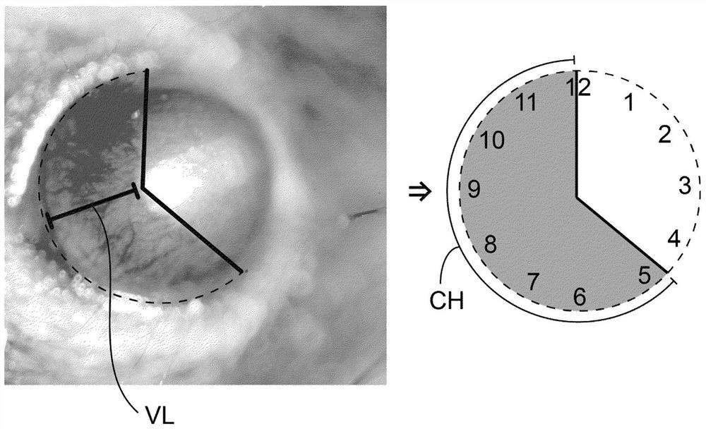 Compounds for treating ocular diseases associated with excessive vascularization