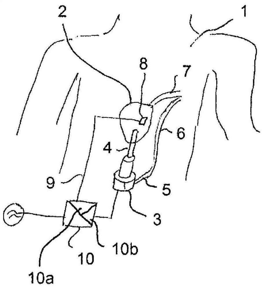 Control device and heart pump or heart pump system incorporating same