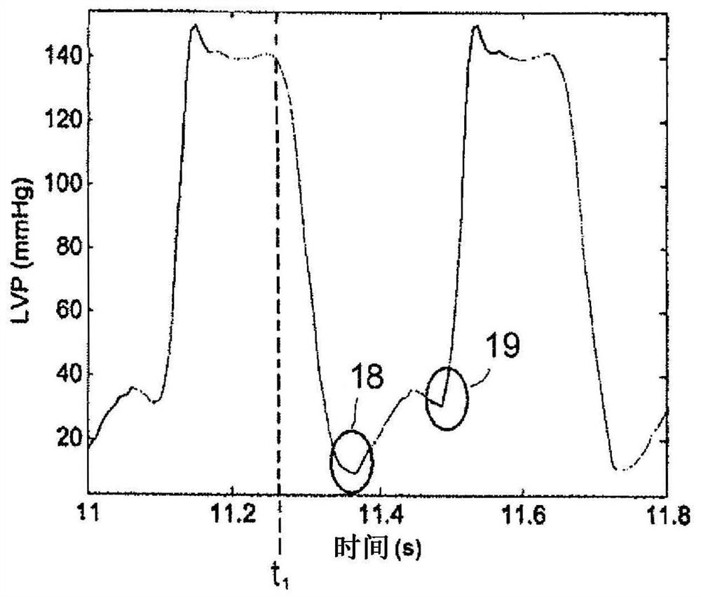 Control device and heart pump or heart pump system incorporating same