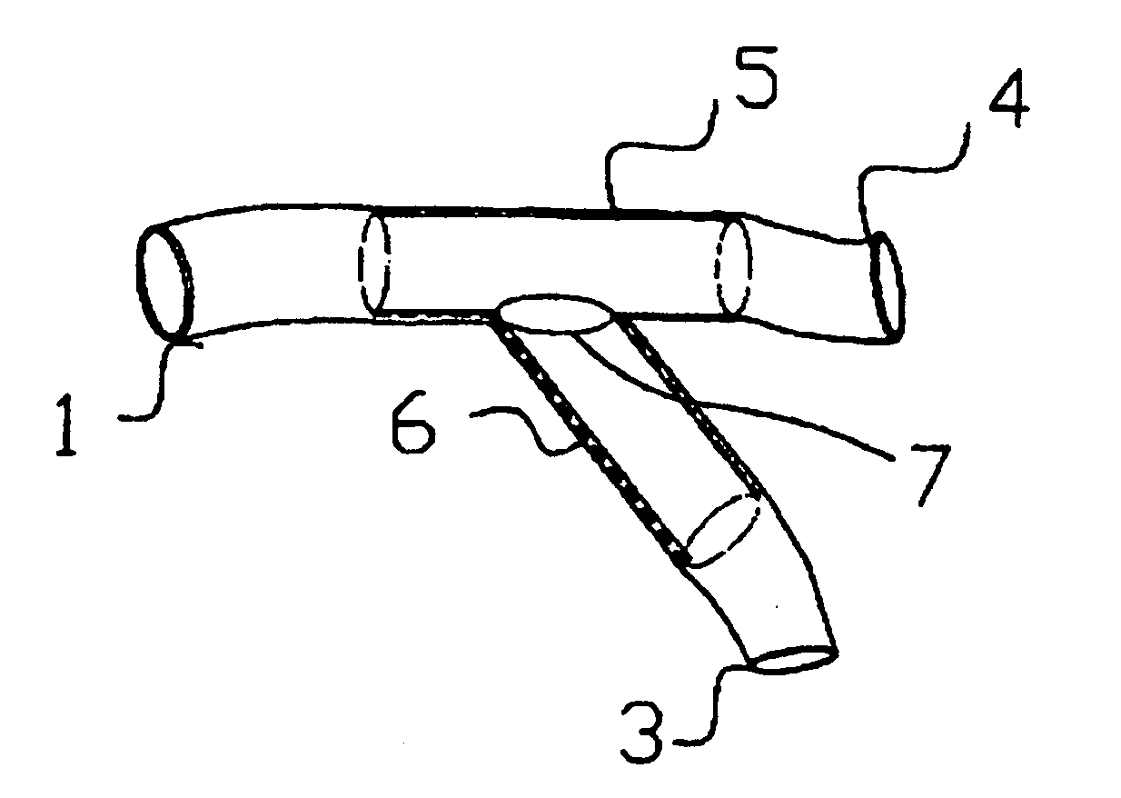 Catheter device for delivery of stents to bifurcated arteries