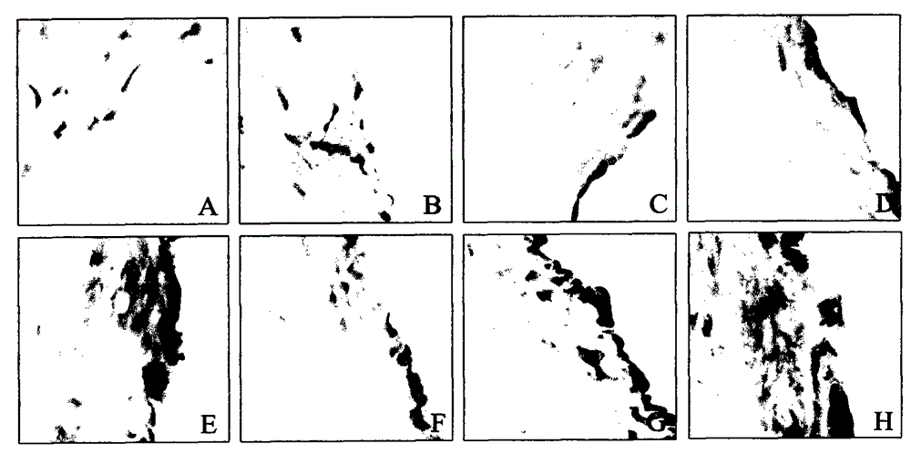 Pharmaceutical composition for preventing essential hypertension and its application