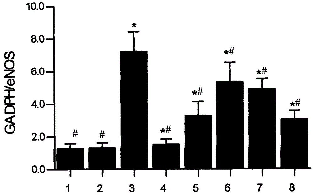 Pharmaceutical composition for preventing essential hypertension and its application