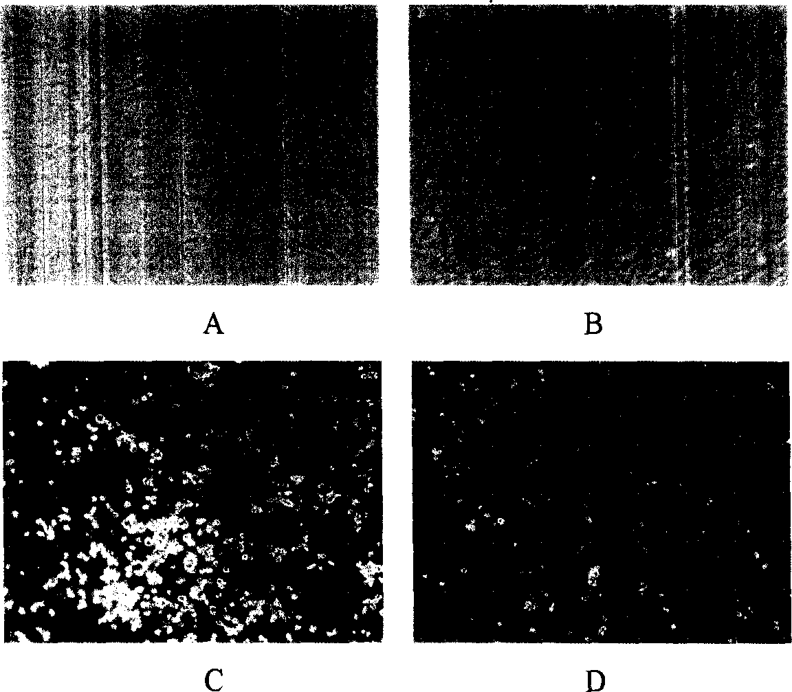 Method for sorting primary human marrow mesenchy malstem cell by monoclonal antibody ZUB4 immunomagnetic bead