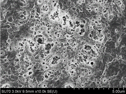 Preparation method of medical metal implant surface embedded with chitosan microsphere collagen coating