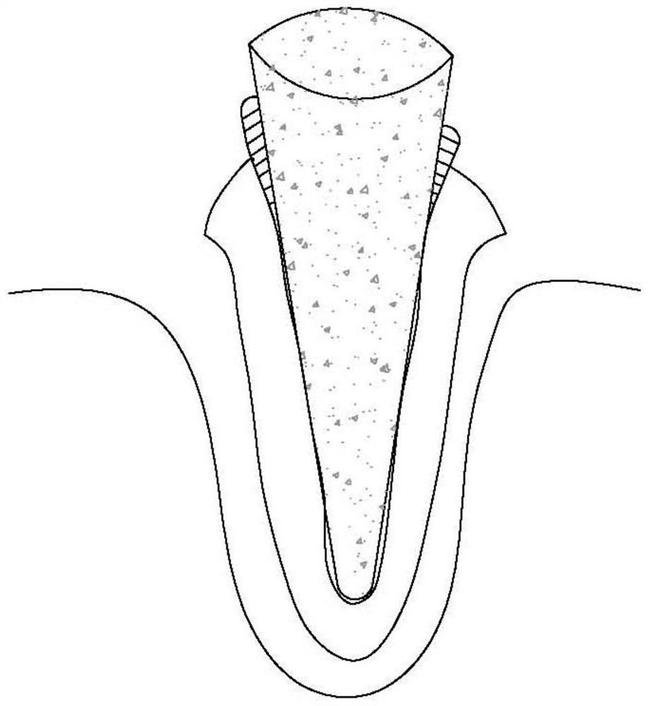 A root canal disinfection core that is convenient for clinical operation and its preparation method