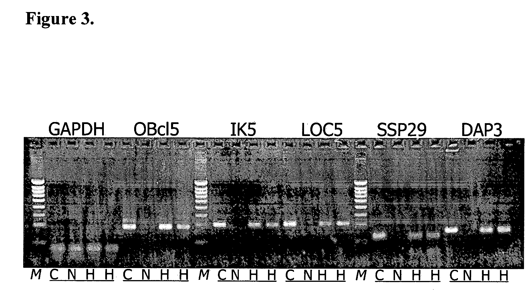 Polypeptides and nucleic acids encoding these and their use for the prevention, diagnosis or treatment of liver disorders and epithelial cancer