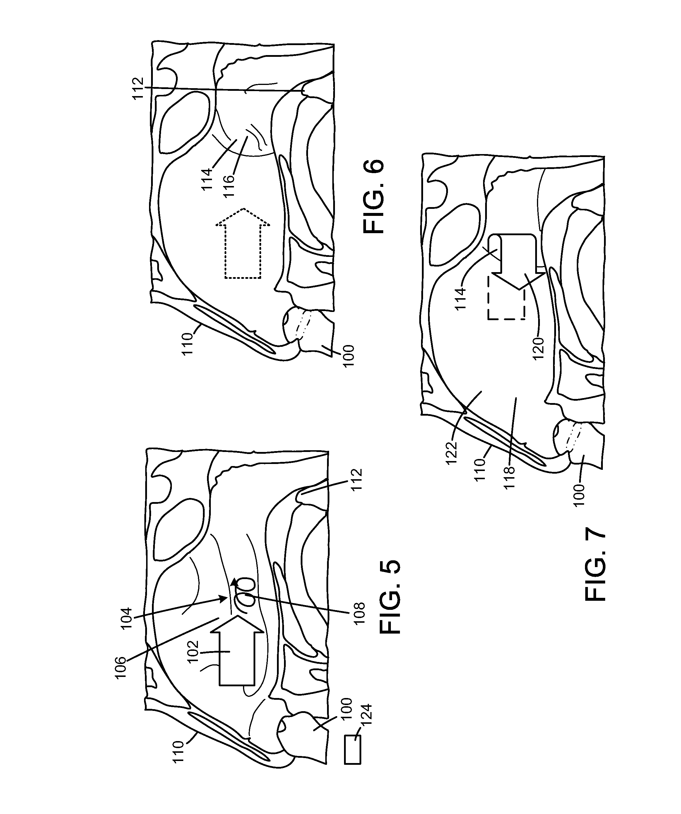 Pharmaceutical composition and nasal rinsing device therefor