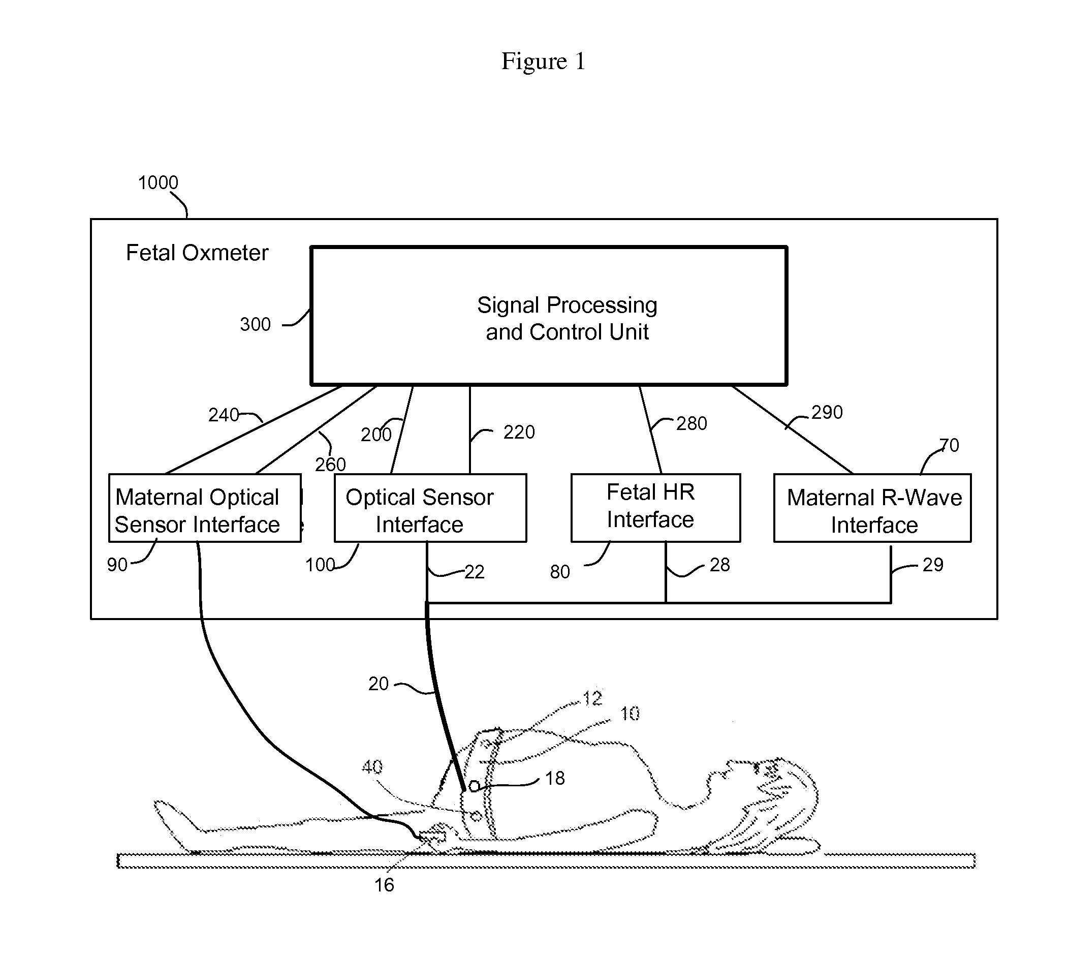 Method and Apparatus for Non-invasive Fetal Oximetry