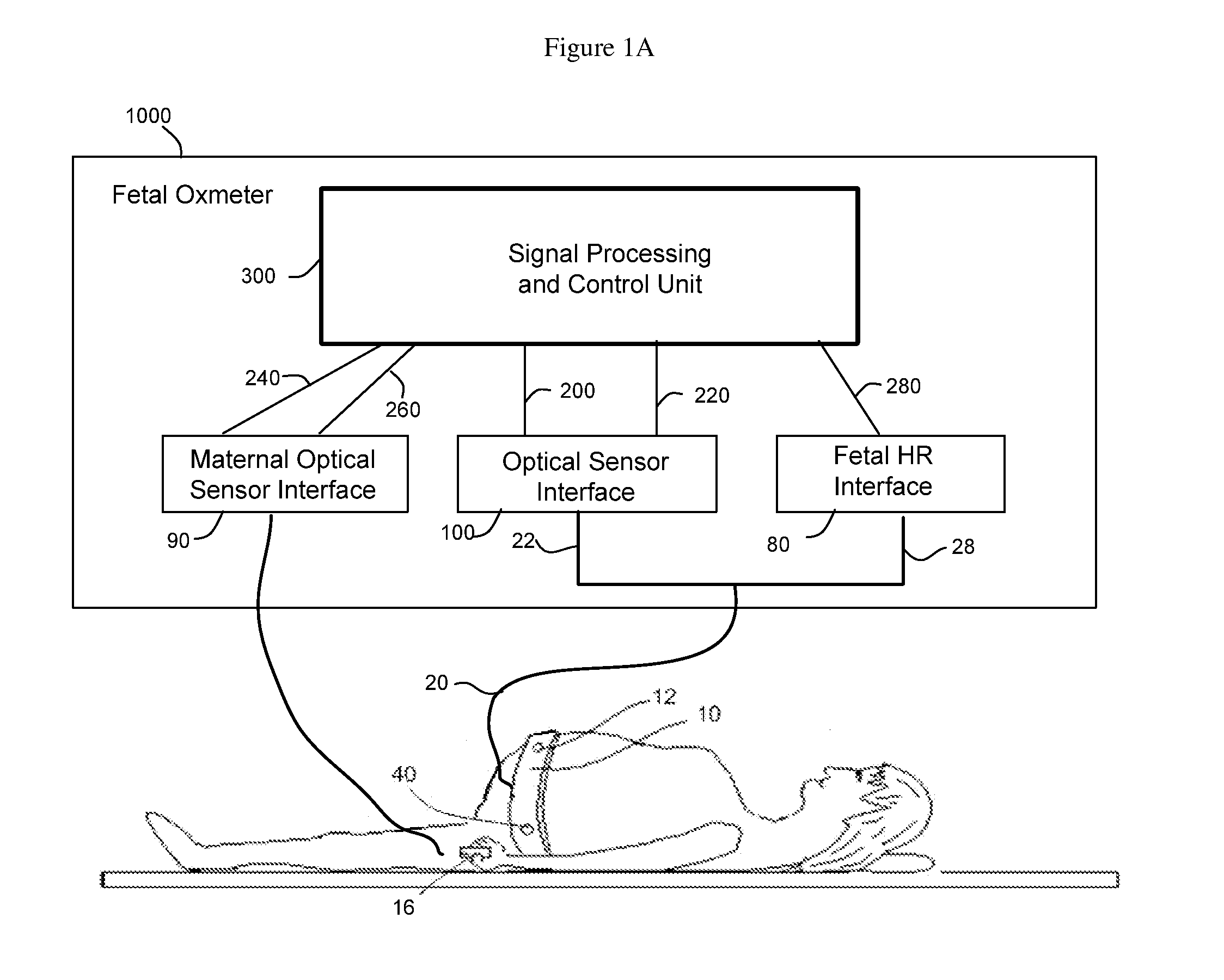 Method and Apparatus for Non-invasive Fetal Oximetry