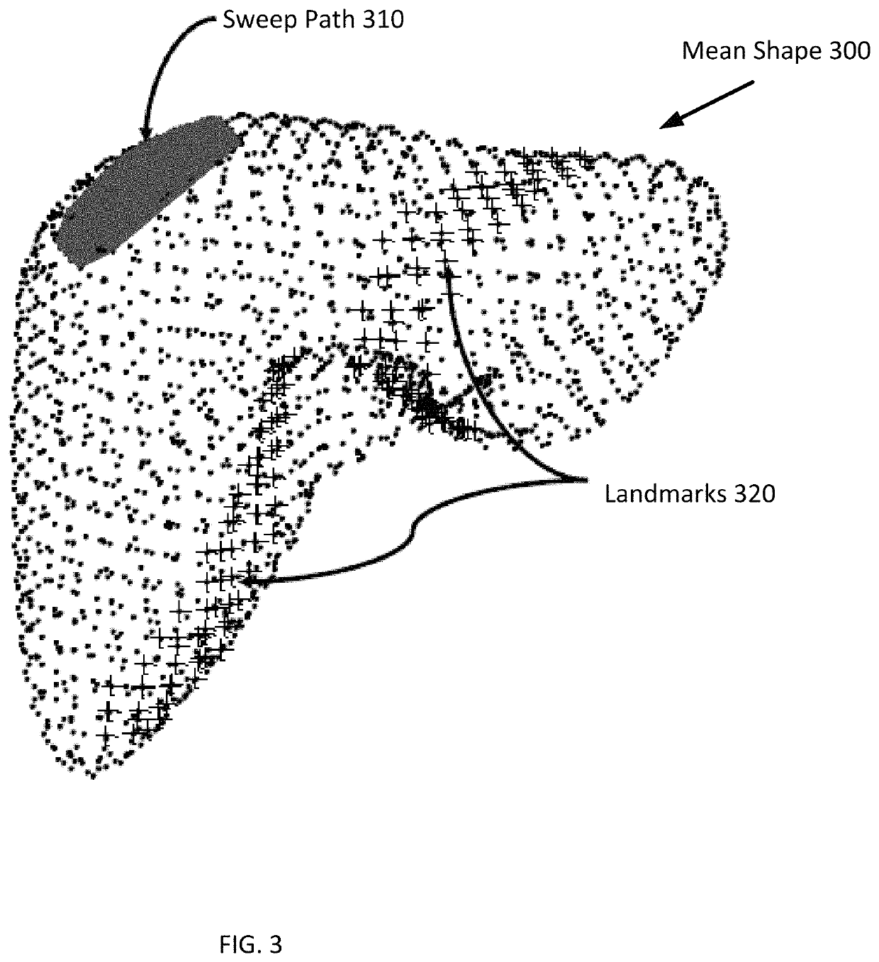 Deformable registration of preoperative volumes and intraoperative ultrasound images from a tracked transducer