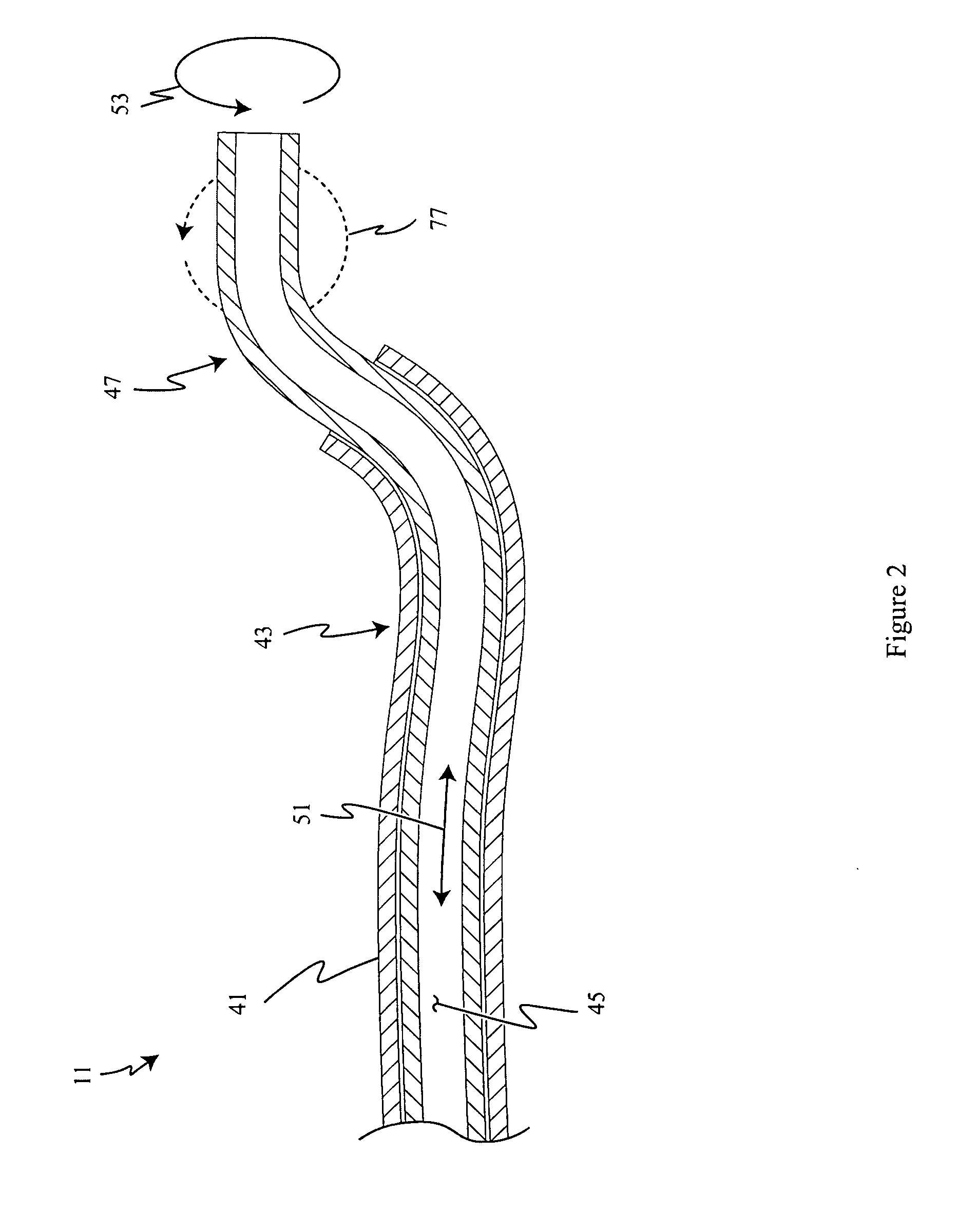 Endotracheal tube and stylet