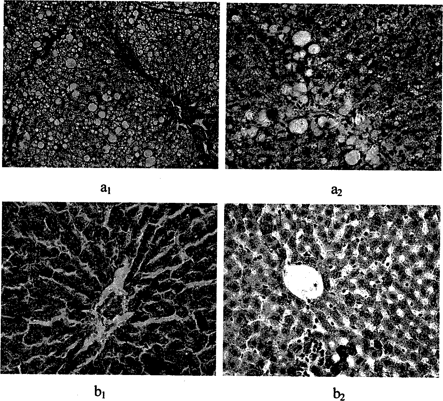 Construction method of rat hepatocirrhosis and osteoporosis animal model