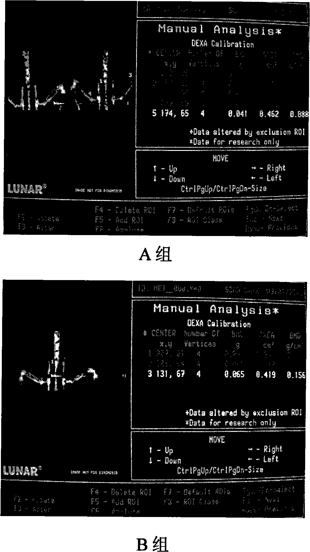 Construction method of rat hepatocirrhosis and osteoporosis animal model