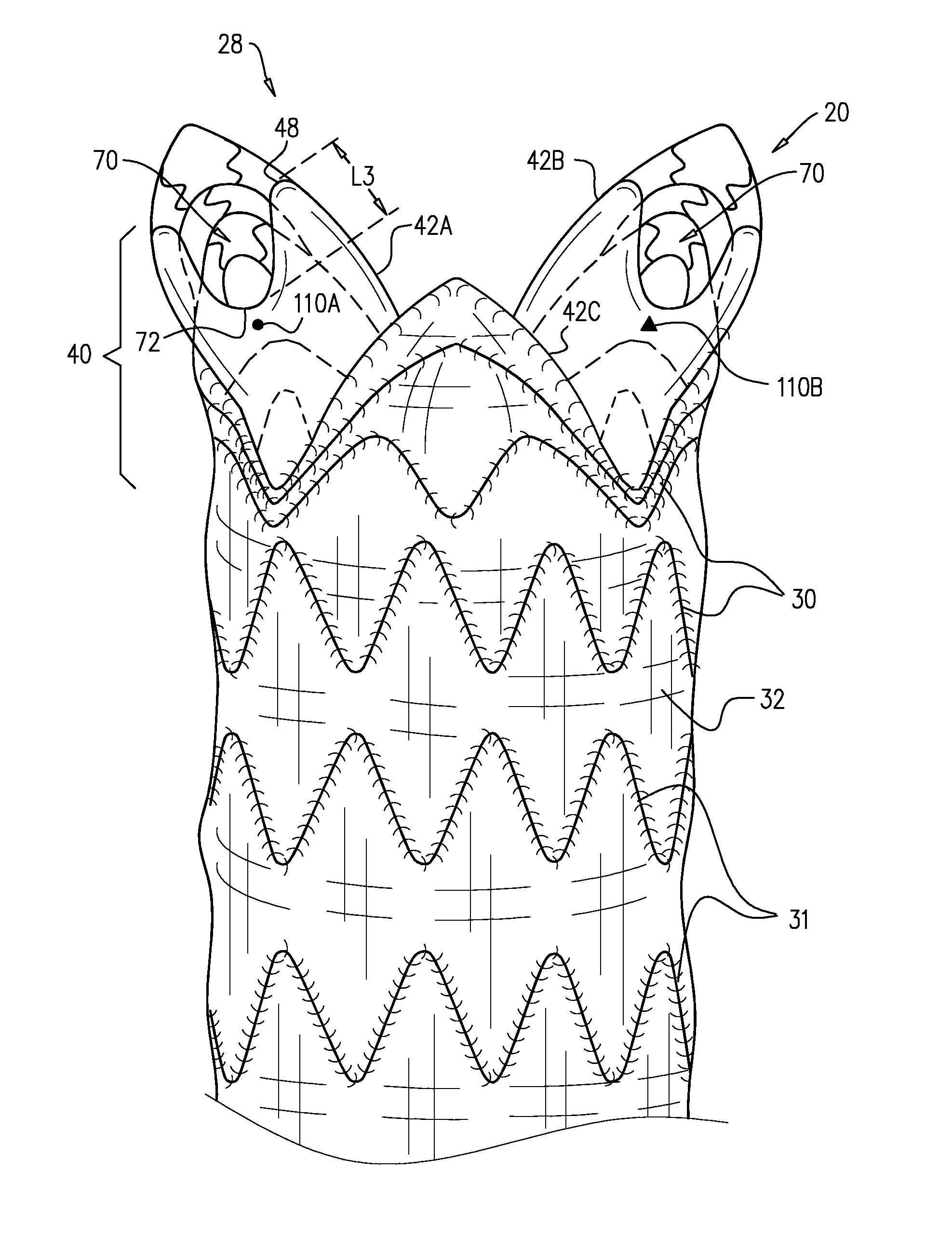 Ascending aorta stent-graft system