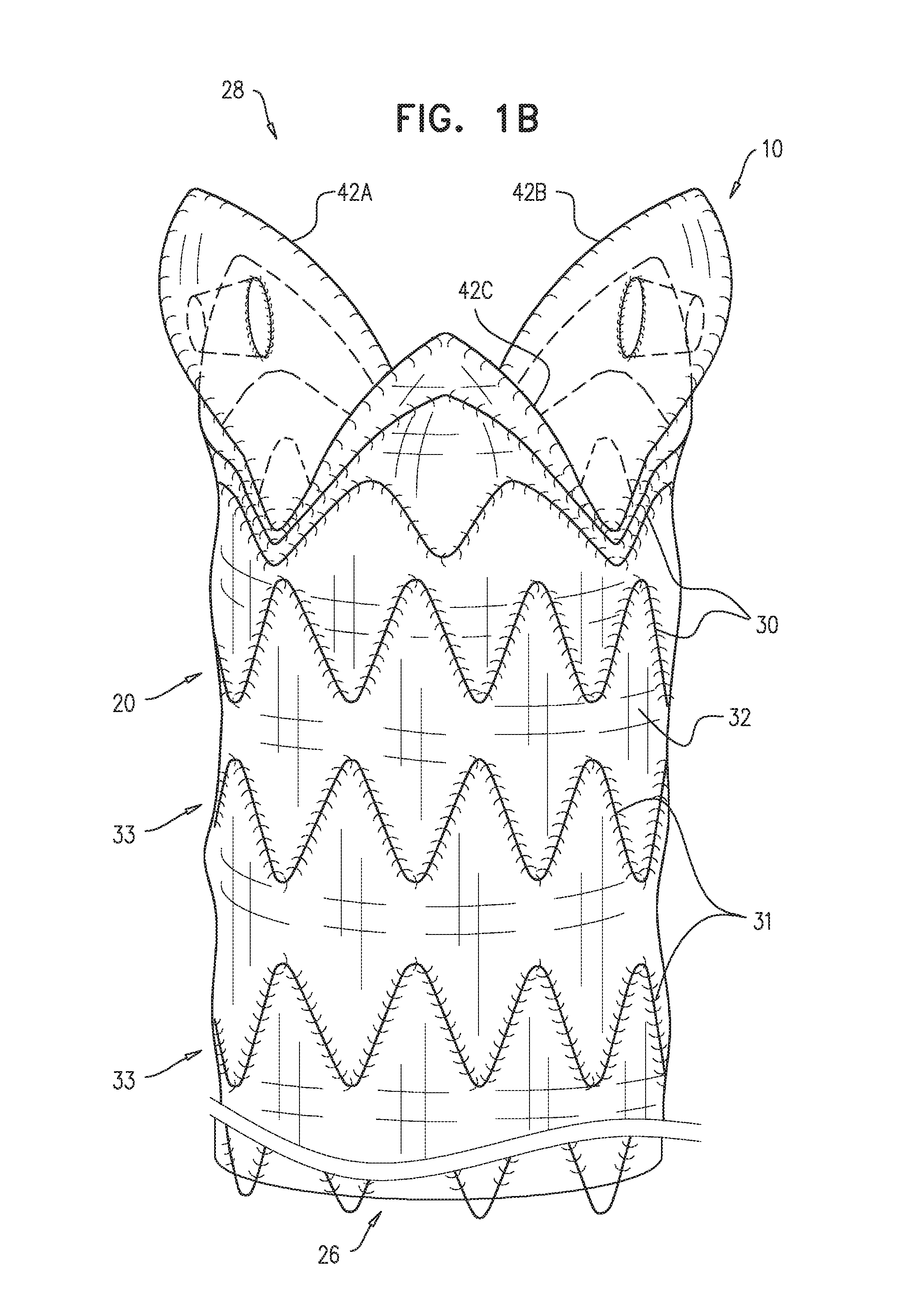 Ascending aorta stent-graft system