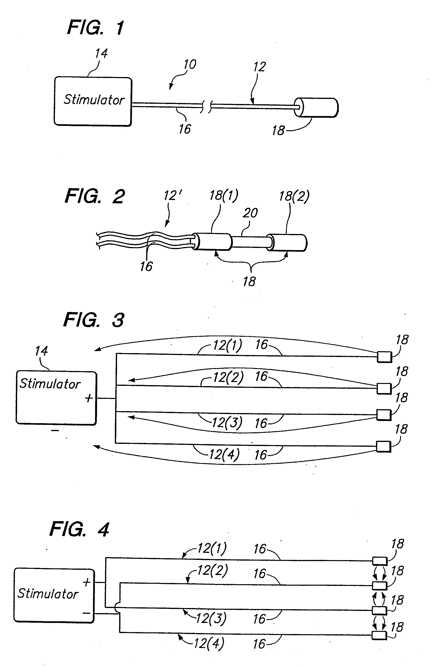 Method of intravascularly delivering stimulation leads into brain to stimulate the spg