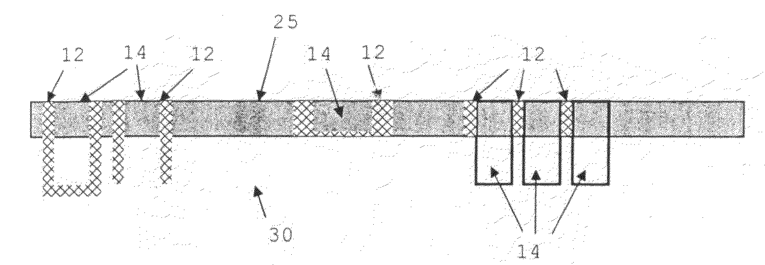 Tissue integration implant