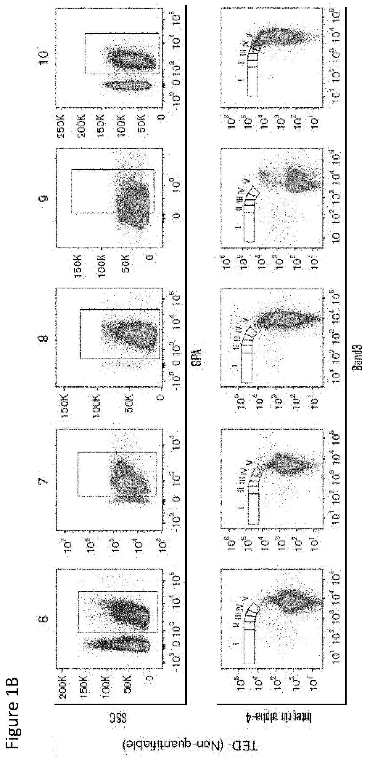 Terminal erythroid differentiation as a biomarker for prognosis and treatment, and therapeutic target in myeloid malignancies