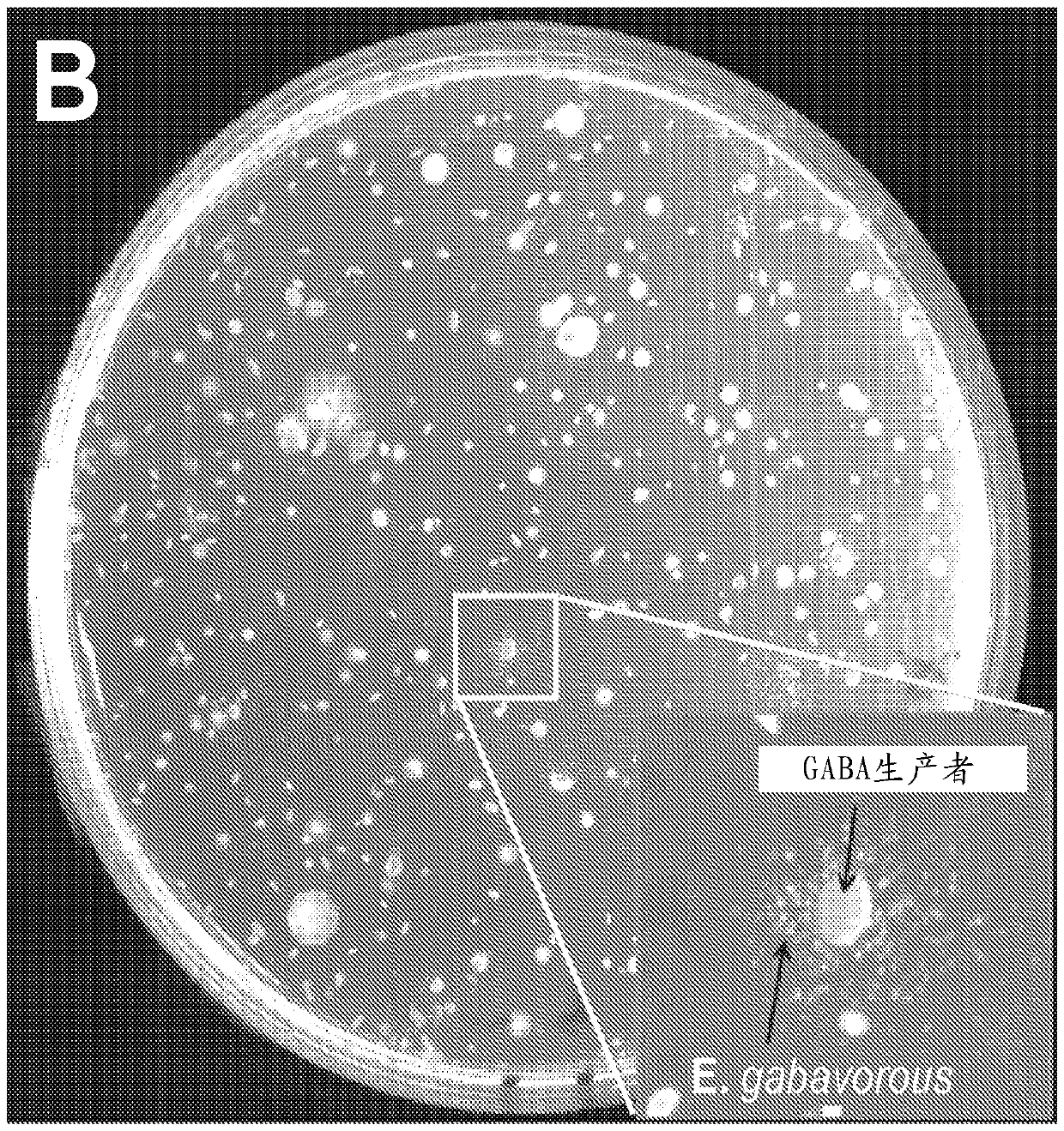 Modulation of the gut microbiome to treat mental disorders or diseases of the central nervous system