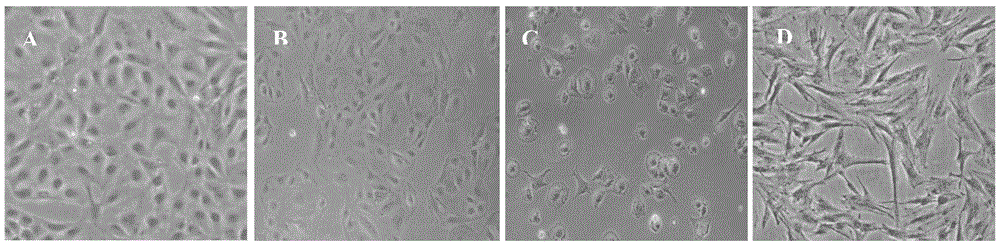 Method for constructing machin progenitor leydig cell immortal line