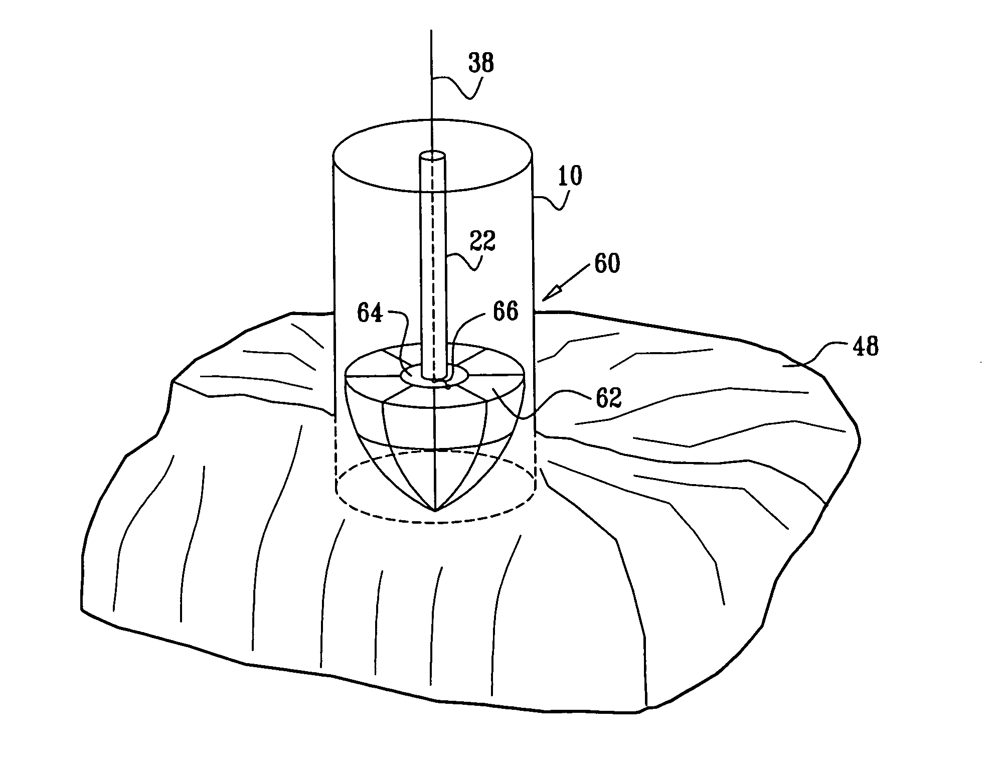 Phased-array for tissue treatment