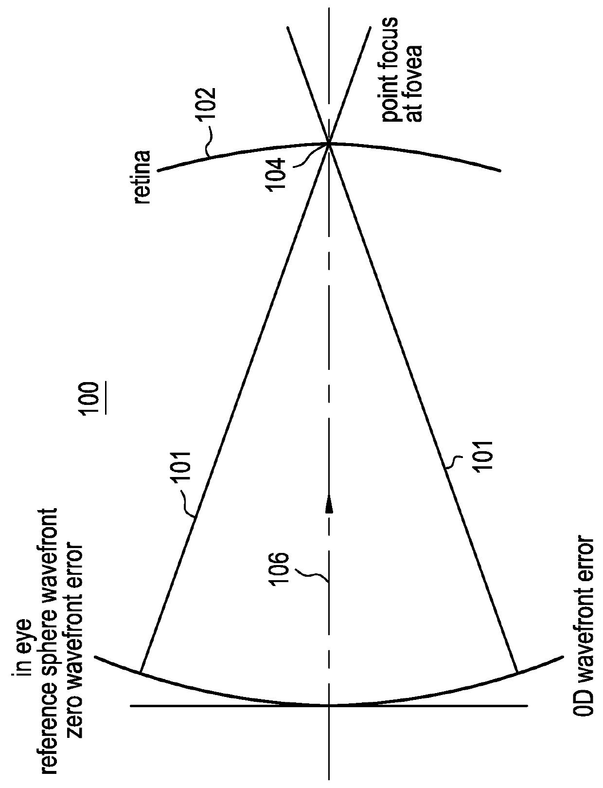 Ophthalmic lens comprising lenslets for preventing and/or slowing myopia progression