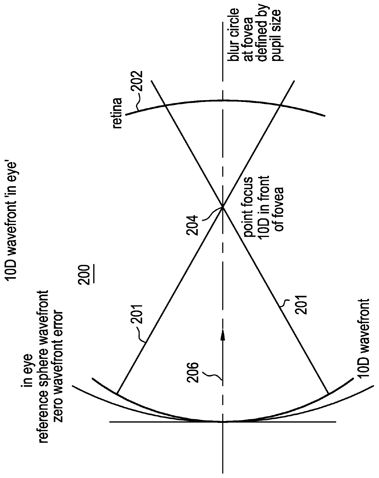 Ophthalmic lens comprising lenslets for preventing and/or slowing myopia progression