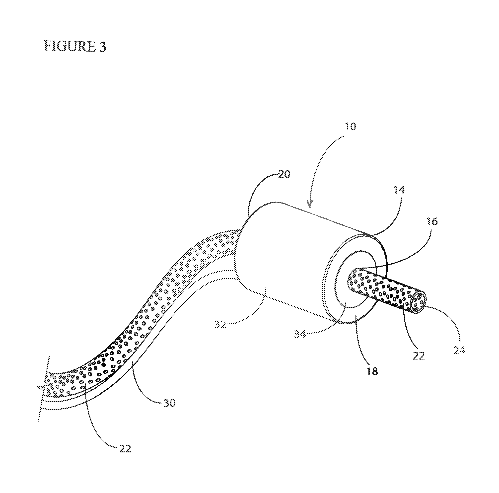 Device for use in endoluminal vacuum therapy