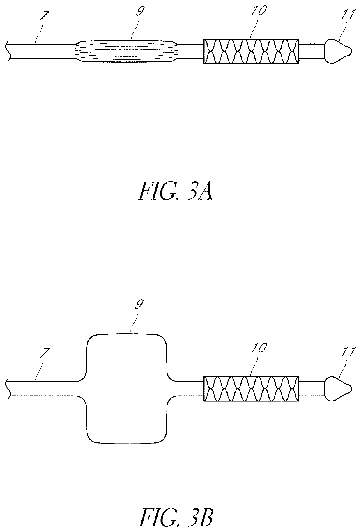 Percutaneous heart valve delivery and implantation system enabling fracture of a previously present valve