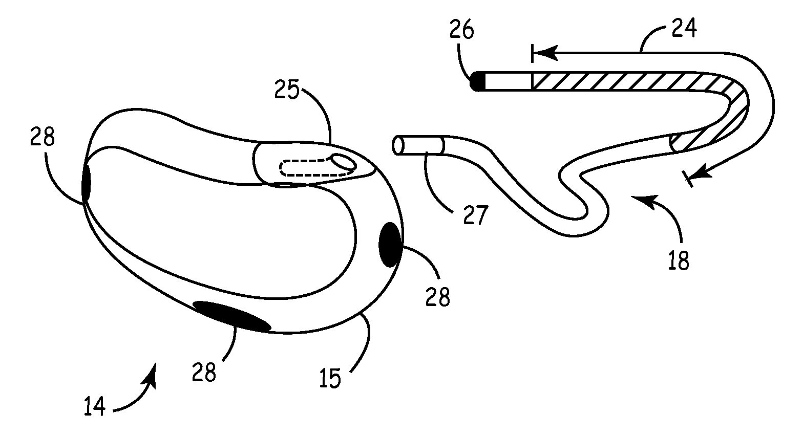 Method and apparatus for detecting arrhythmias in a medical device