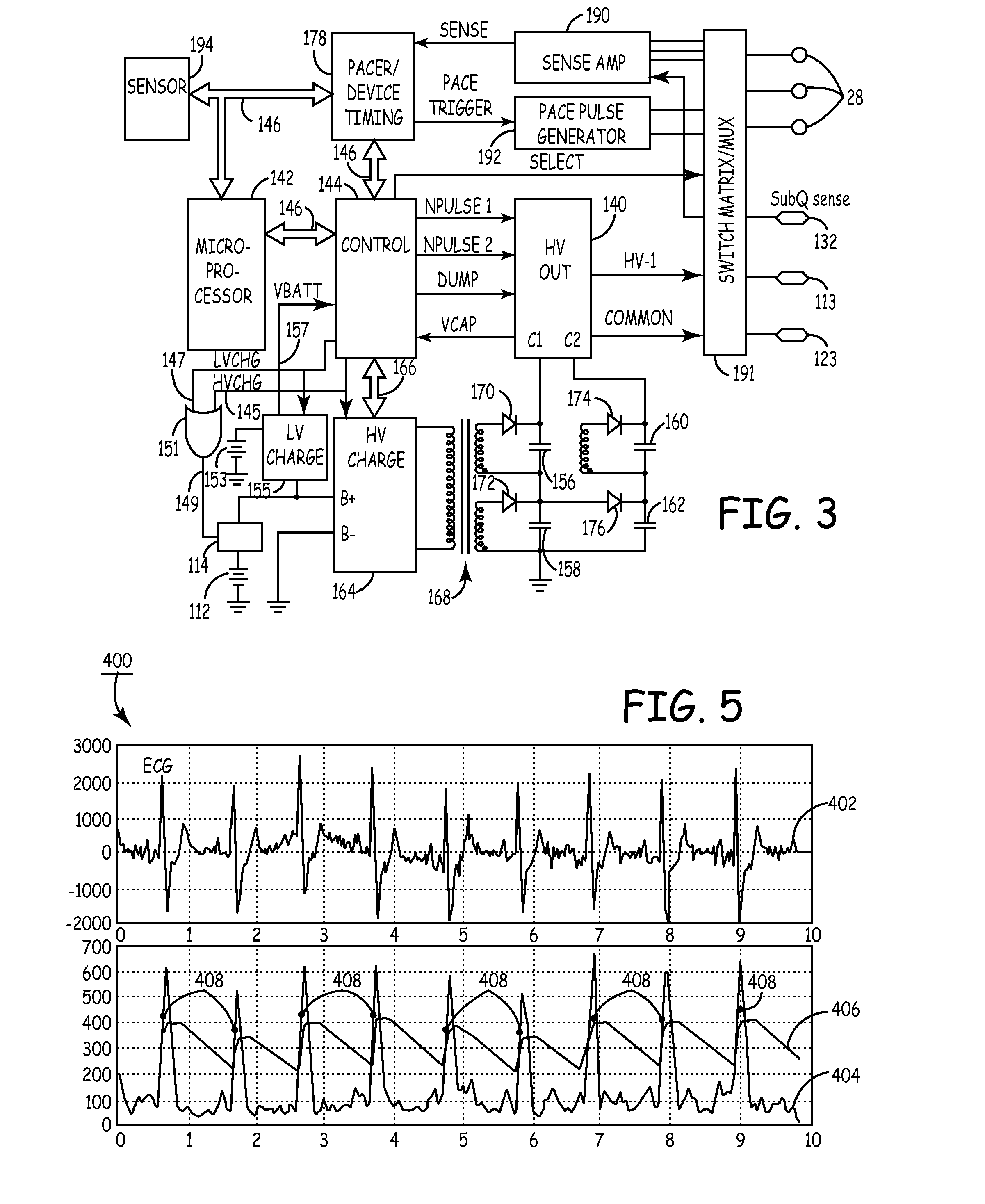 Method and apparatus for detecting arrhythmias in a medical device