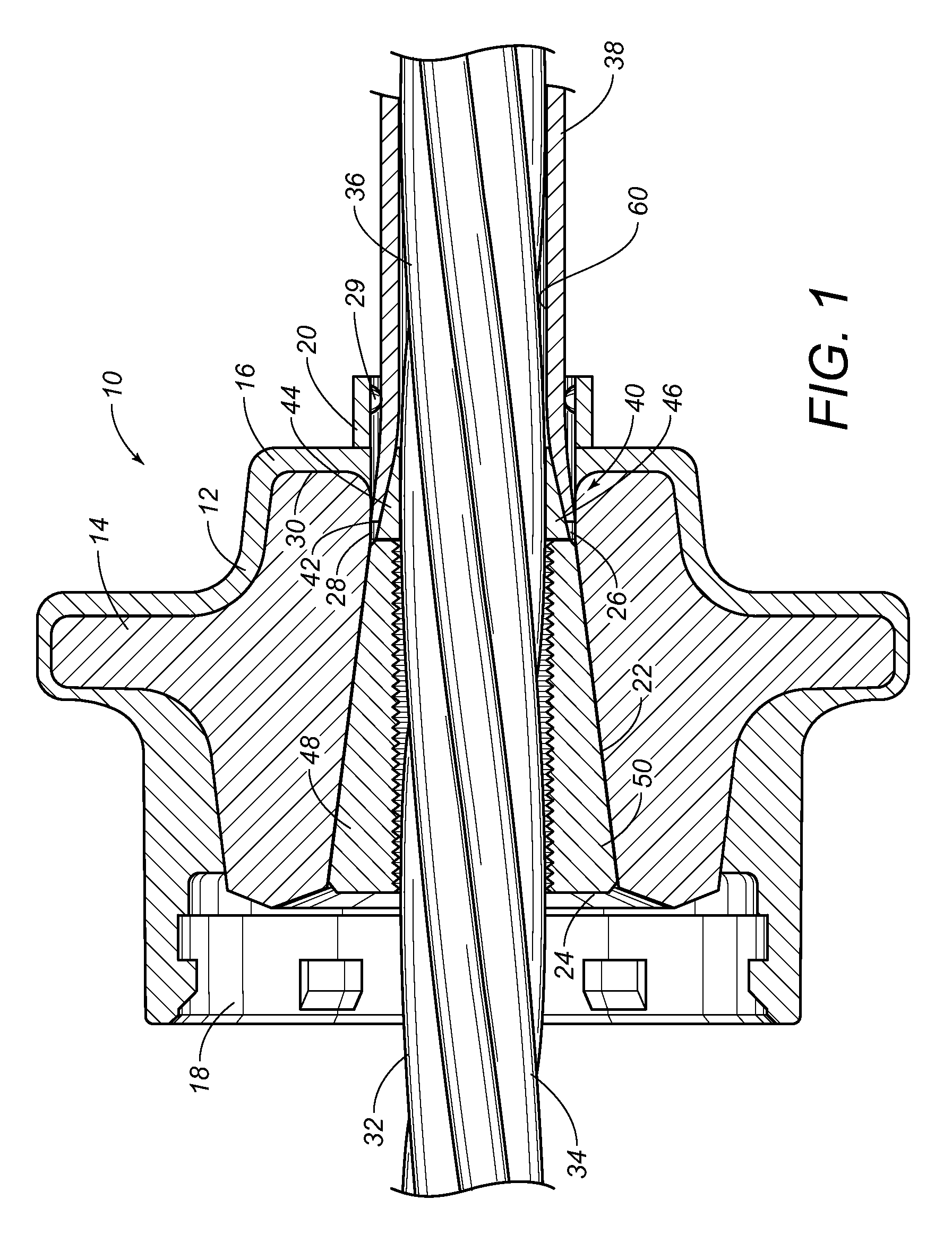 Sealing trumpet for a post-tension anchorage system