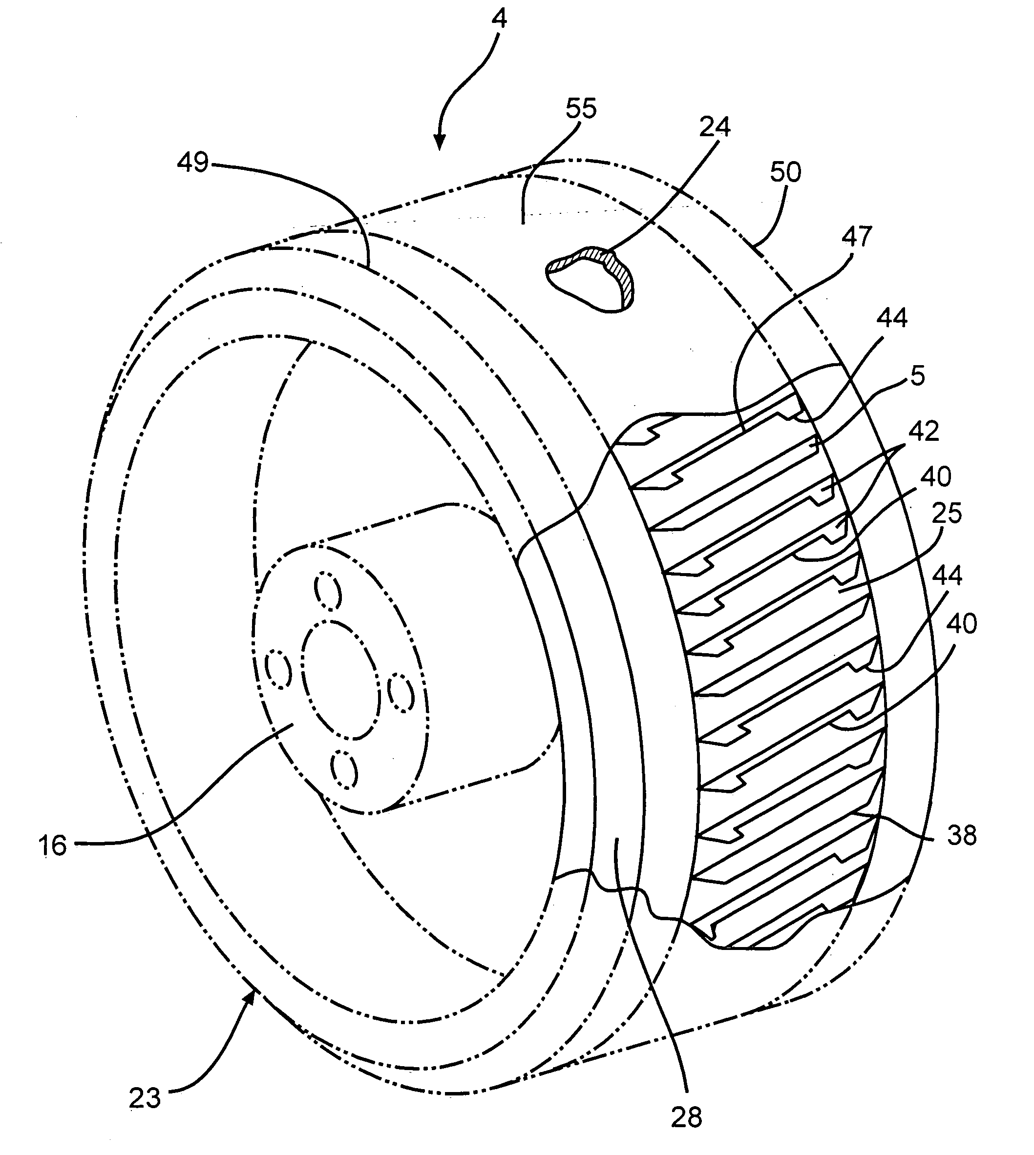 Chopper and method of chopping unwound items