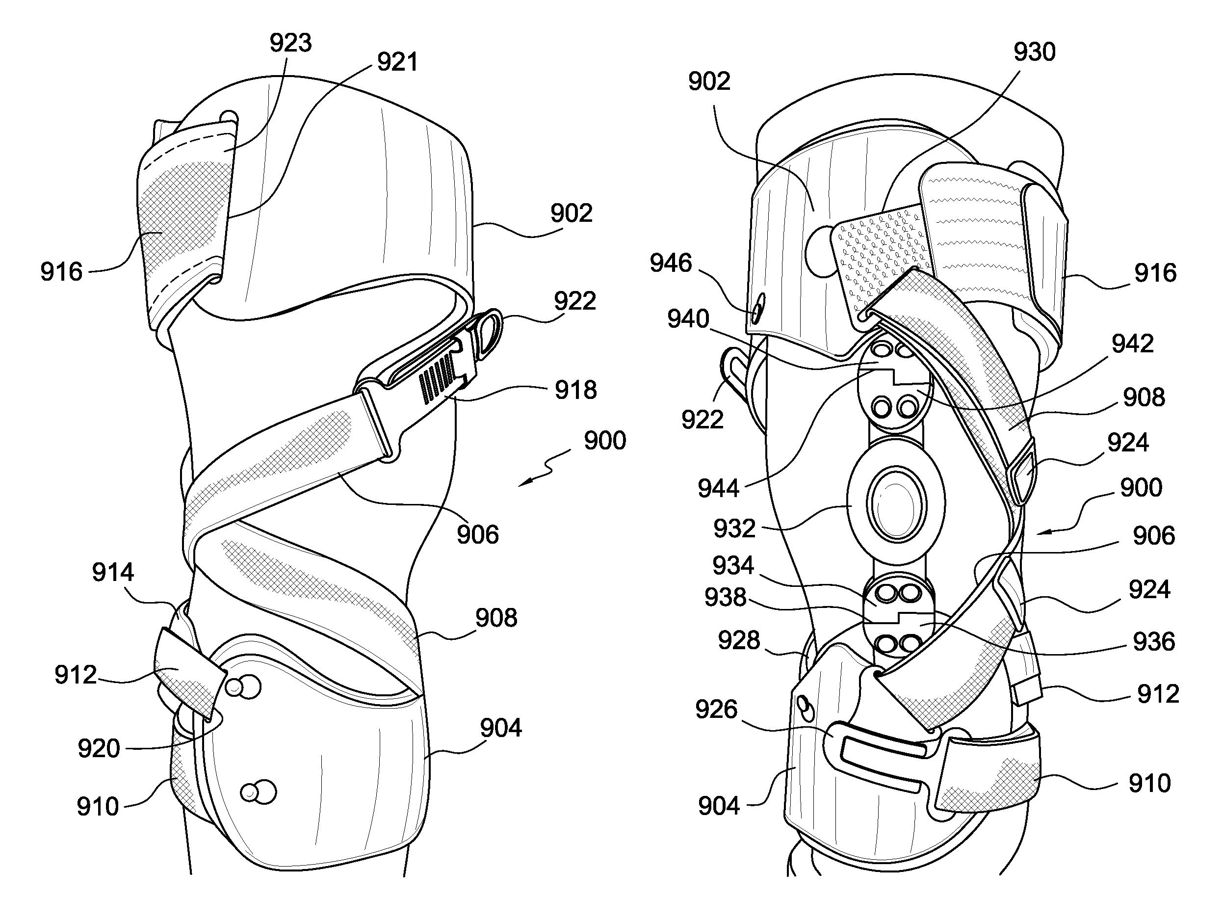 Orthopedic device